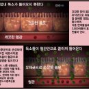 아이비에스 (IBS) 이미지