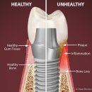 내원백운 이미지