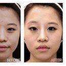 연세내외의원 네이버블로그