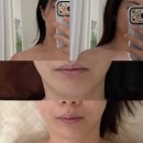 소안로 | [렌느에스테틱] 부천피부관리 윤곽관리 잘하는 곳 1회만으로 승모근이 내려갔어요 신부관리 추천