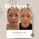 미담케어 | 상남동 모공 미백 탄력 리프팅 피부관리 천방케어 미담뷰티 - 매끈한 피부결로 거듭나다 (고객들의 리뷰)