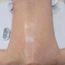 루덴스 | 인천 만수동 뷰티관리 “루덴스“ 관리 후기