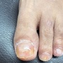 탄방대한약국 | 탄방동네일 [LCN라운지 네일더설렘 탄방점] 방문 후기 발톱 무좀 관리 완벽하게 해결된 경험