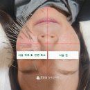 양귀비한의원 네이버블로그