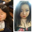 &lt;&lt;노원 성형외과 상담 투어&gt;&gt; 광고 1도 없는 생생 터지는 후기 ***스압 주의***