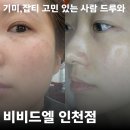 씨유 서영더엘점 | 김포 장기동 피부관리 비비드엘 색소 집중 기미관리 솔직후기