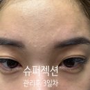 찐으로 제대로 하는 파메스테틱 전문점 구서동 주블룸스킨랩에서 제대로 된 관리받고 피부좋아지고...