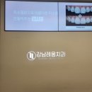 유재석치과의원 | 누운사랑니 사랑니발치 강남역 &#34;강남레옹치과&#34; 발치 후기