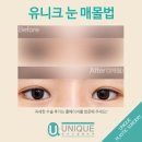 리얼성형외과 이미지