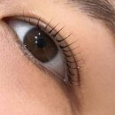 브리즈성형외과의원 이미지