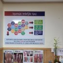 힐스템 찜질테라피 이미지