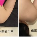 주미옥에스테틱 네이버블로그