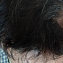 우리참옻 | 곡성참옻<옻오르지않는 참옻진액> 솔직 후기