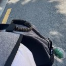 (주)에이더블유피 | 손가락 골절 수술 후기 1(서울대학병원,수부외과,간호병동,부분마취,철심,핀고정술)