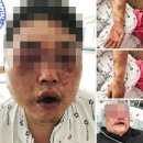 광산구-136 이미지