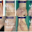 미소사랑의원 이미지
