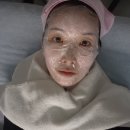 레이저 | [내돈내산] 압구정로데오 피부과 색소침착 주근깨 피코 레이저 후기