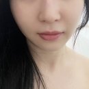 아느크 에스테틱 네이버블로그