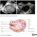 배란일 증상을 알고 배란기계산기 쓰면 임신에 도움이 되요. 이미지