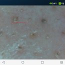 피부의여왕 이미지