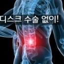 오케이정형외과 Daum카페