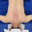 정우아파트_상 | 창원상체관리 전문 예담에스테틱 창원점 후기