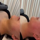 어울림빌 | 서산에스테틱 루아뷰티 슬림젯 이중턱 관리 후기