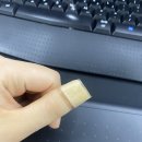 칼에 손톱 베였을때 후기 / 정형외과 / 현대연합정형외과