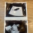 동래구 보건소 | [임신 5-6주차]아기집 확인,임신확인증발급, 동래구 보건소 산전검사 후기