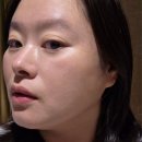 영메디케어 이미지