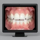 오거리연세드림치과의원 | 드디어 맘에 쏙 드는 치과 찾음! 연세 굿 프 란 트 치과 정착 썰 풉니다