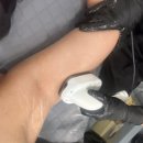 첨단프라자(종합상가) | 첨단피부관리 아비에피부&amp;왁싱 광주첨단점 제로핏빼빼 팔뚝 슬리밍 테라노바 관리 후기