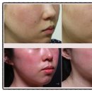 아침나무한의원 이미지