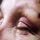 눈사랑한의원 이미지