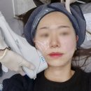 600 | [공지] 울쎄라 600샷 후기｜크림마취 선택 이유와 통증·효과·주기 공유해요