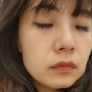 본태의원 네이버블로그