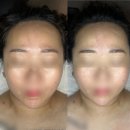 아쿠아트윈빌딩A | 나주피부관리 전문 디바스킨 미네랄아쿠아스파 2단계 관리 솔직후기