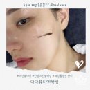 다다스킨케어 | 다다뷰티엔왁싱_웨딩촬영 필수 스킨플래닝 후기