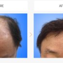 노블라인의원 이미지