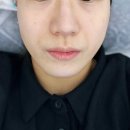 광주MS뷰티아카데미 | 광주뷰티교육 도연 아카데미 홈쎄라 팔자주름 인중 왁싱 후기
