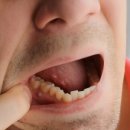 탑티어치과의원 네이버블로그