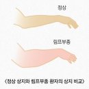 포유플러스