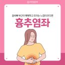더튼튼정형외과의원 | 을지로정형외과 동묘더튼튼의원 ) 갈비뼈 아래 통증, 단순 근육통 아닐 수도 있습니다 - 흉추염좌