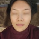 서남시장건너 | 대구 달서구 MTS 피부관리 새로 태어나는 꽃피우는 여자