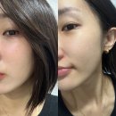 이노트 | 모공블랙헤드까지 잡는 폼클렌징, 이노트 트러블케어 클렌저 후기