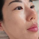 (주)이지시스템 | 평택피부관리 로즈아트스킨 이지다 접촉성피부 튼튼이지샷케어