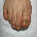 매료네일 문제성전문점 이미지