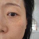 써니짐 | 부천 상동 피부관리 써니뷰티 후기(색소 미백 케어/주근깨제거)