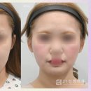 투턱 이미지