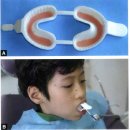 디어스치과의원 | 강동구어린이치과 소아치과 전문의가 알려주는 불소도포의 모든 것